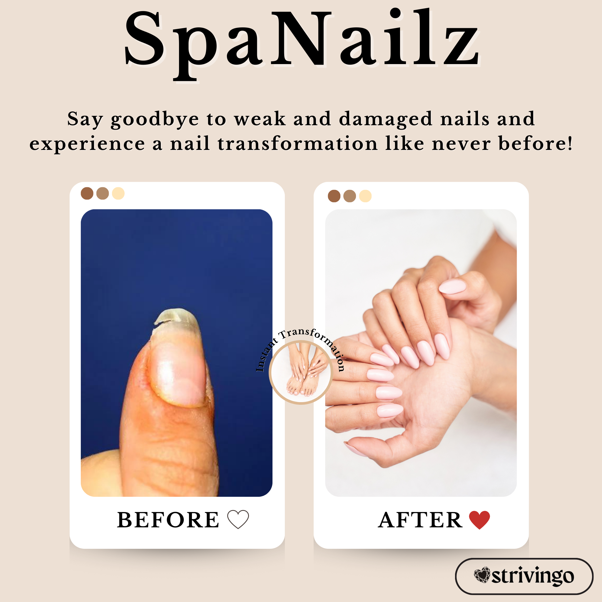 SpaNailz™ 3 in 1 Nail Repair Set | incl. Brush & UV Lamp