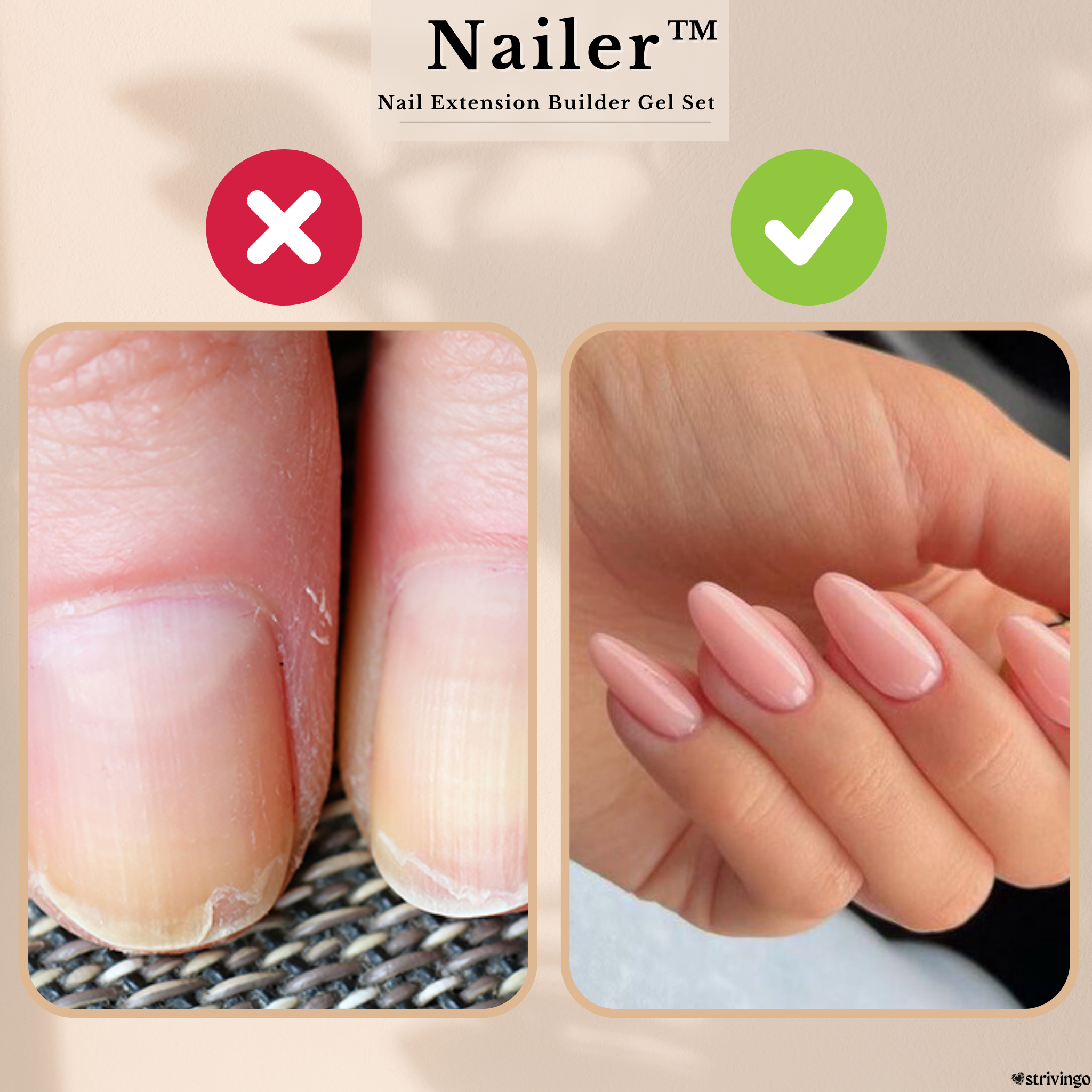 Nailer™ Nail Extension Builder Gel Set | incl. UV-lamp!